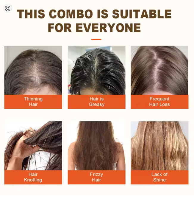 شامبو الشعر بالزنجبيل يمنع تساقط الشعر - Image 2